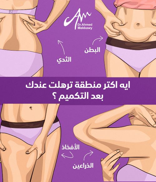 أسباب ترهلات الجسم